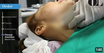 살만 빼면 이중턱이 없어질까요?